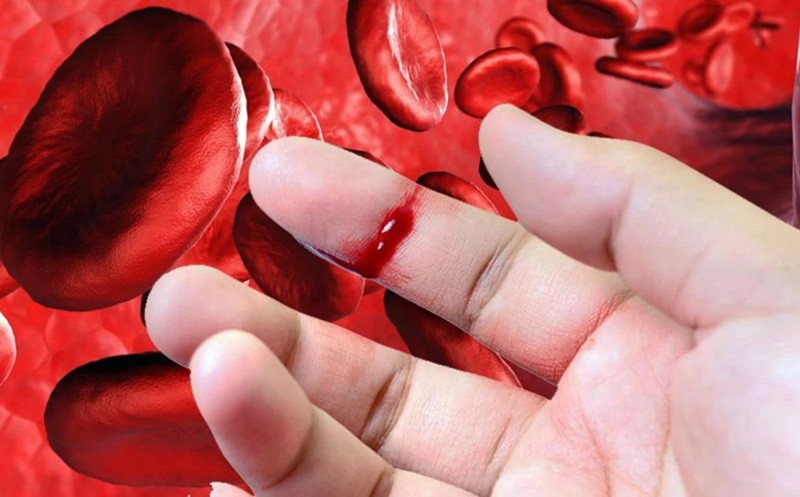 Гемофілія: розвінчуємо міфи