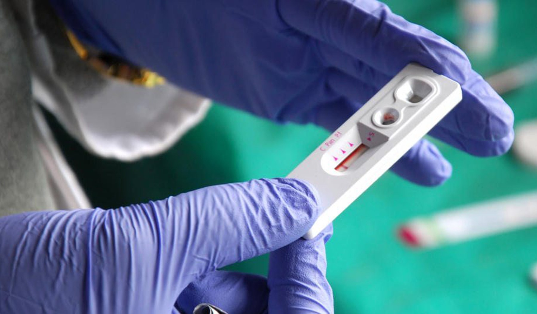 Тестування на ВІЛ та вірусні гепатити безплатні для ветеранів