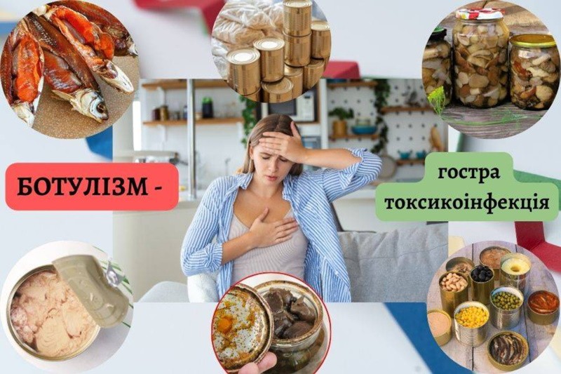 Ботулізм: харчове отруєння з тяжкими наслідками