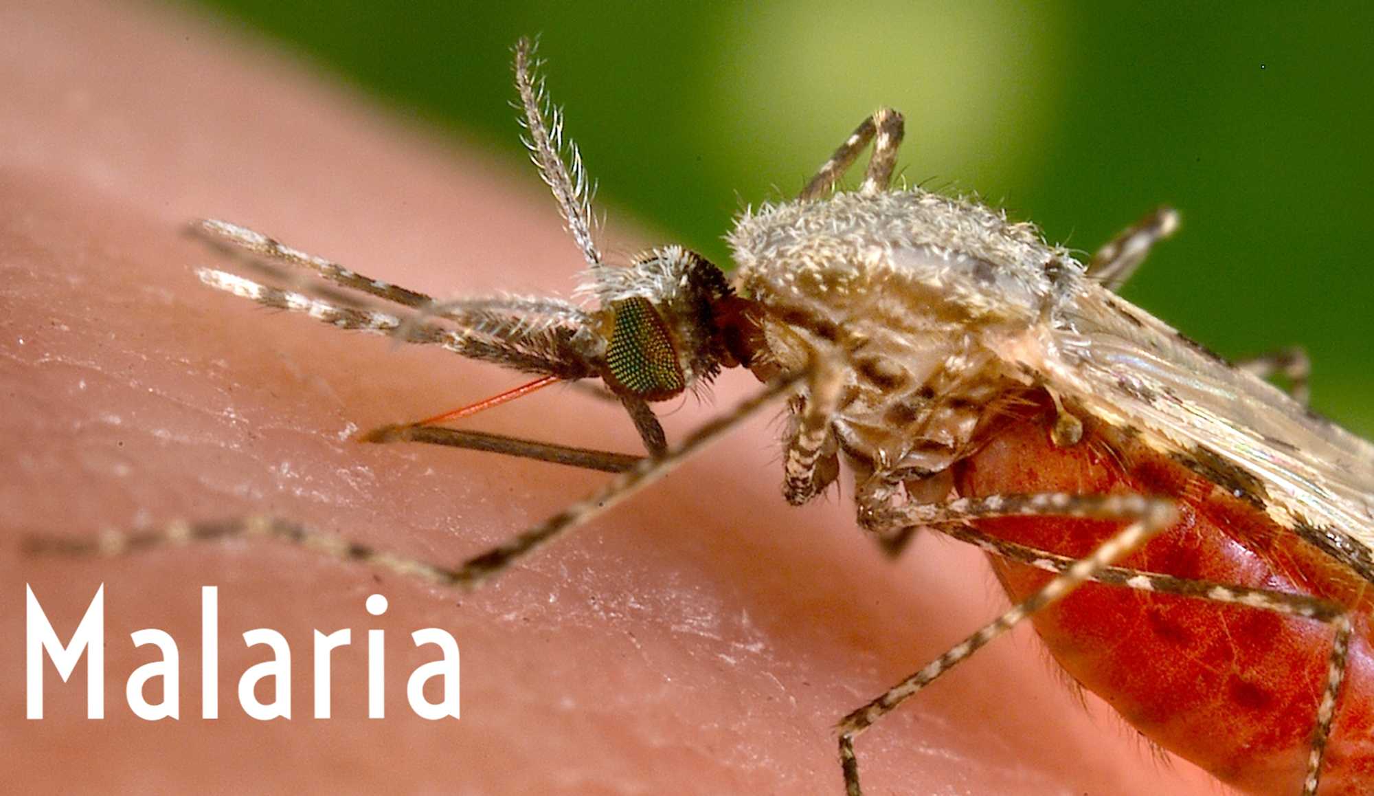 «Привозна» хвороба: що варто знати про малярію