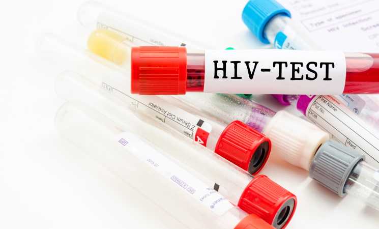 Тест на ВІЛ: чому його бажано зробити кожному