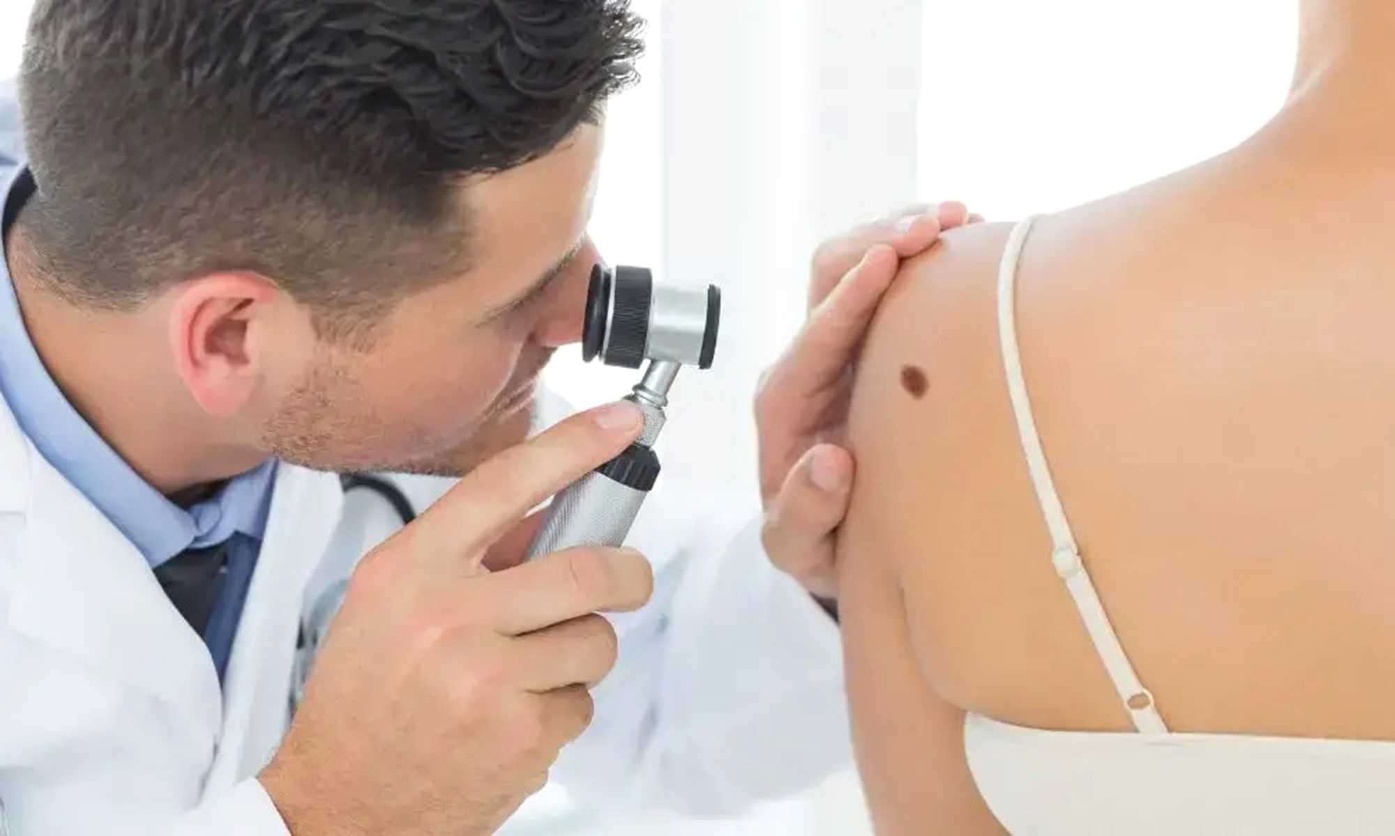 Зміни на шкірі – нагальна потреба звернутися до лікаря