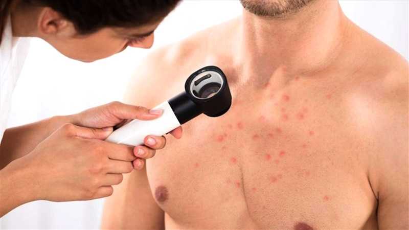 Церкаріоз: що це таке та як із ним боротися