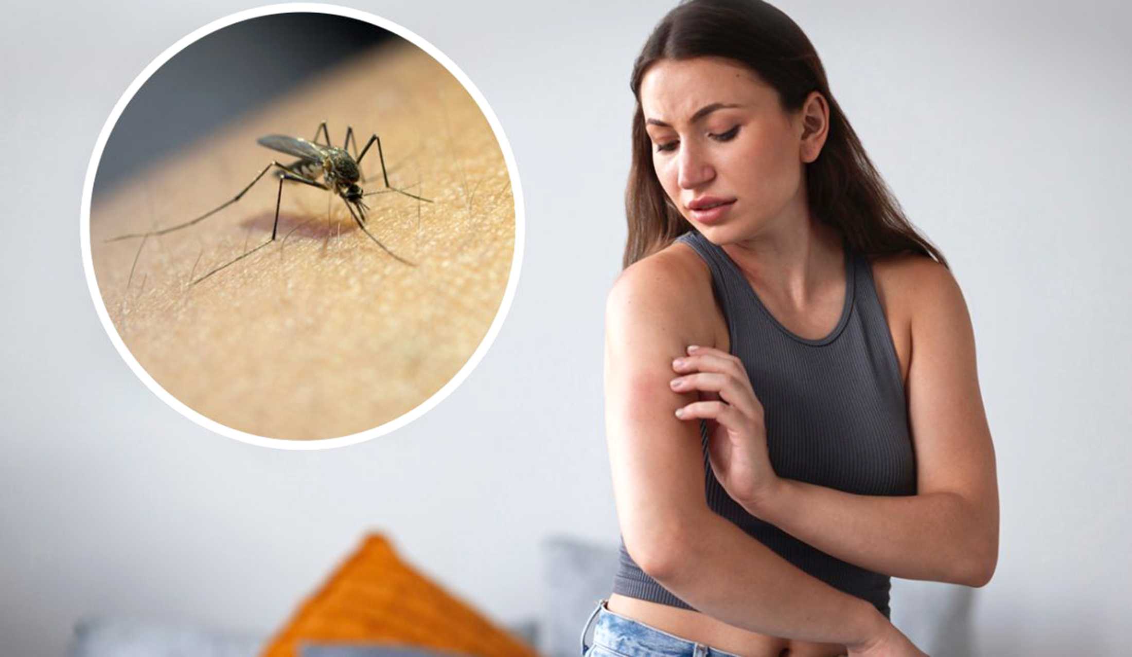 Алергічна реакція на укуси комах: у яких випадках необхідна лікарська допомога