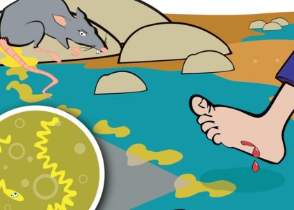 Лептоспіроз – серйозна літня загроза
