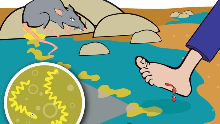 Лептоспіроз – серйозна літня загроза